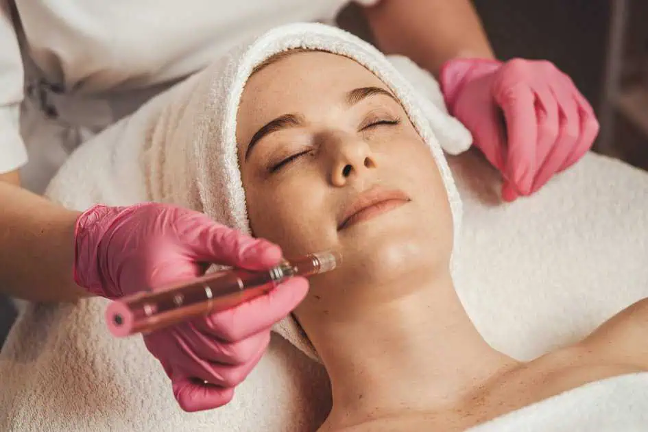 Microneedling Treatment in Frederick, MD by Halo Medspa And IV Bar